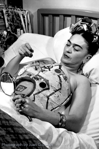 Frida painting her plaster corset in hospital.
